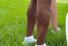 Las espeluznantes imágenes de la pierna derecha de Tiger Woods por primera vez desde el accidente
